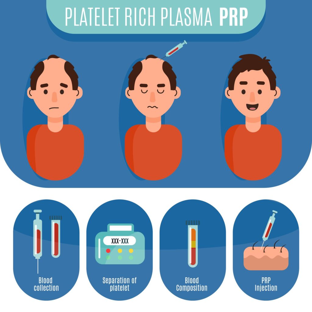 What is PRP ?